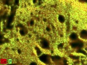 Biomaterials micro-XRF