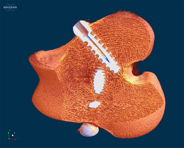 Sheep bone with Ti implants