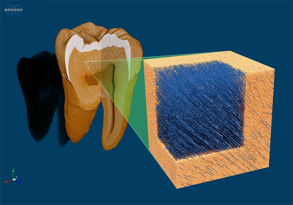 Tooth dentin tubules scanned with micro-CT